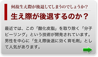 生え際が後退するのか？